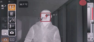 Target thermal image of body temperature